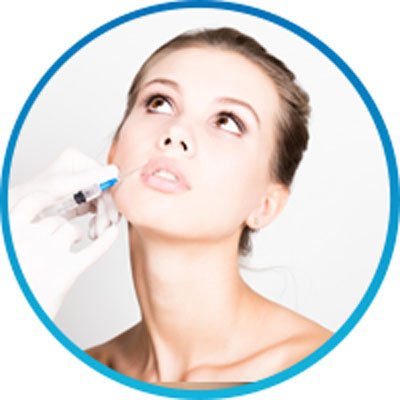 Bellafill Dermal Filler