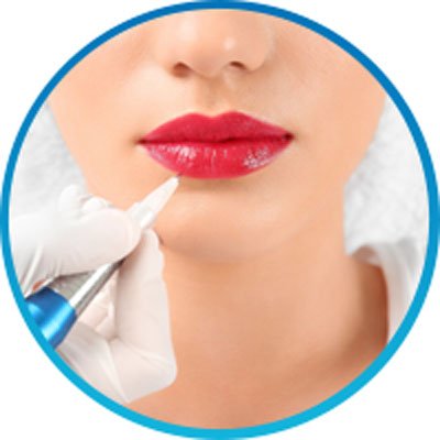 Lip fillers (Ravenesse & Teosyal)