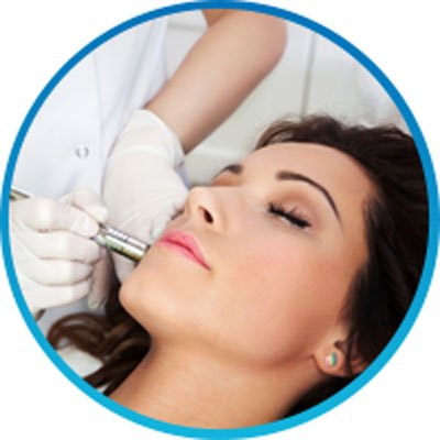 Microneedling